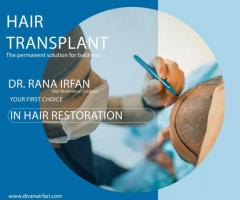 Hair transplant services in islamabad