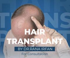 Best Hair transplant in islamabad