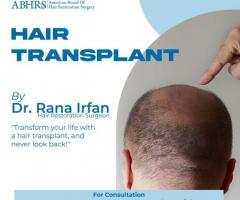 Hair transplant services available in Islamabad Pakistan