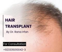 Best Hair transplant Services in Islamabad Pakistan