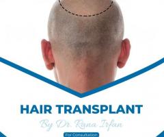 Hair transplant Services by dr rana Irfan at vagus cosmetic Islamabad - 1