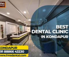 FMS Dental Clinic - Best Dental Clinic in Kondapur Call Now : 08886643230 - 1