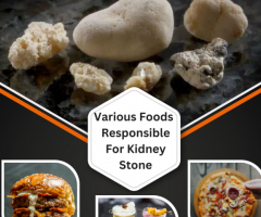 Different Foods Can Lead to Kidney Stones