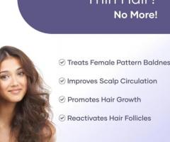 Hair Revival: Minoxidil Solution for Hair Growth