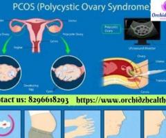 Discover Effective PCOS Treatment in Bangalore with Orchidz Health