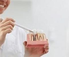 Dental Implant Centre in Kurnool