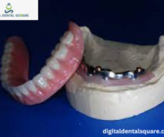 titanium hybrid denture lab