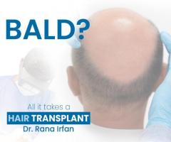 Hair Transplant Service by Dr Rana Irfan in Islamabad - 1