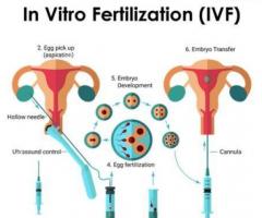 Best IVF Treatment in Bangalore - Orchidz Health