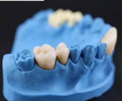 Crown Ceramics Dental Laboratory for Digital Dental Square