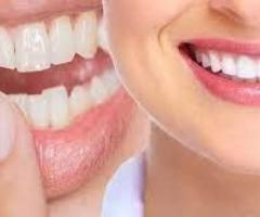 Teeth cleaning and Teeth scaling in Pune | Teeth cleaning in Shivaji Nagar - 1