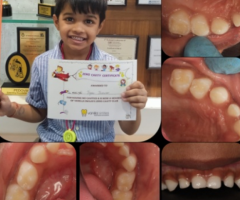 Pediatric Dentist in Pune, Shivaji Nagar | Best Pediatric Dentist in Pune