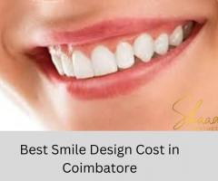 Smile Design Cost in Coimbatore - 1