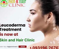 Best Skin and Hair Clinic in Noida - 93196 26767