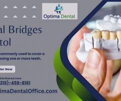 Revitalize Your Smile with Optima Dental Office's Expertly Crafted Dental Bridges in Bristol